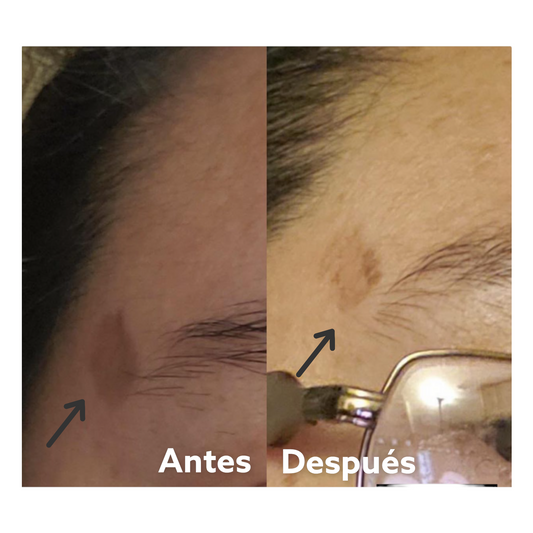 Crema Despigmentante Facial - Whitening Facial Cream