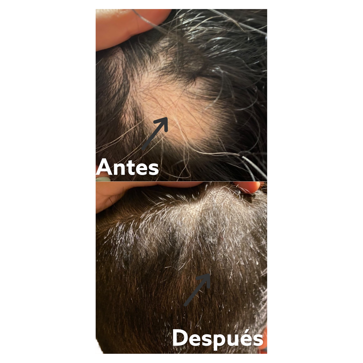 Suero de Crecimiento para Cabello - Big Hair