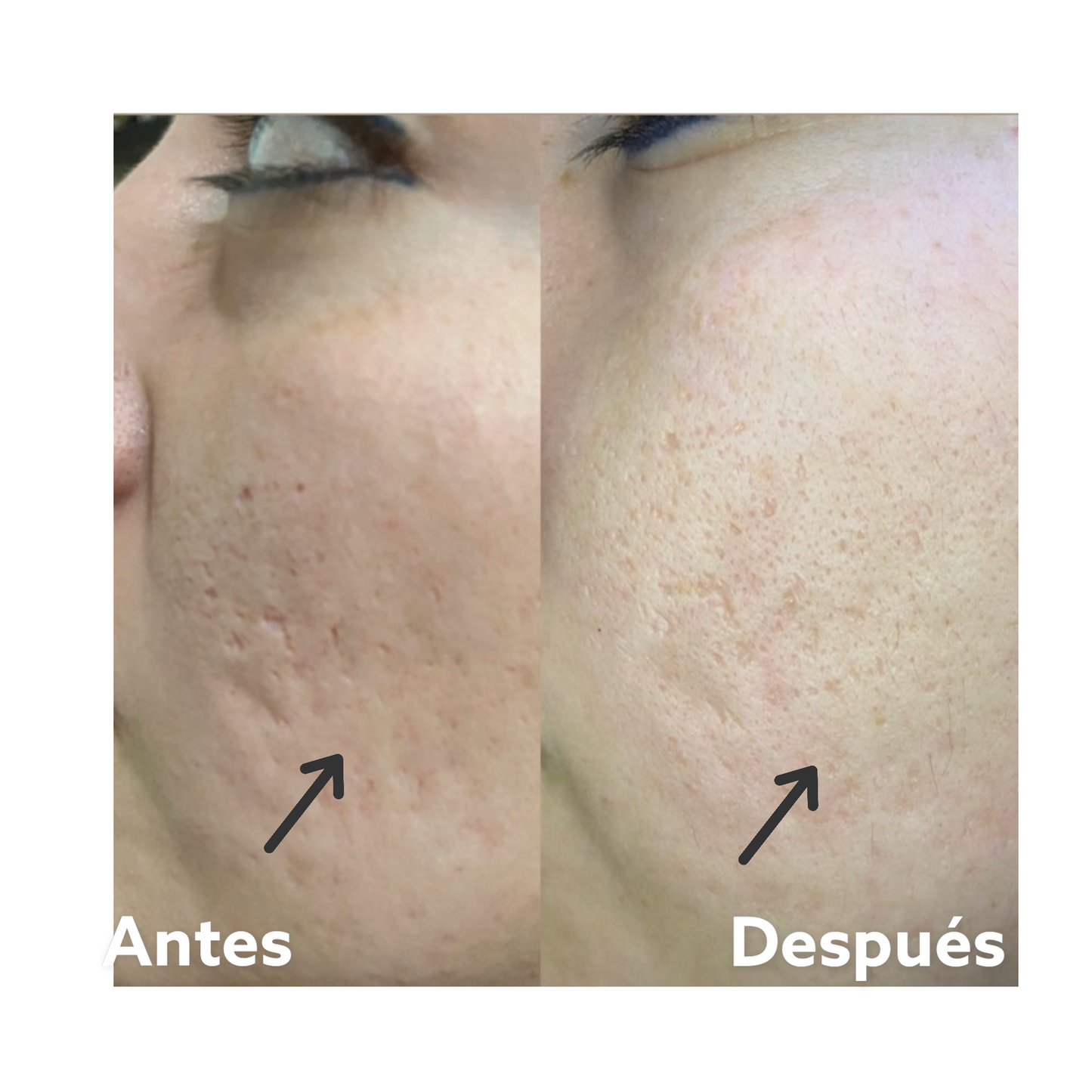 Crema Borradora Mágica - Magic Eraser