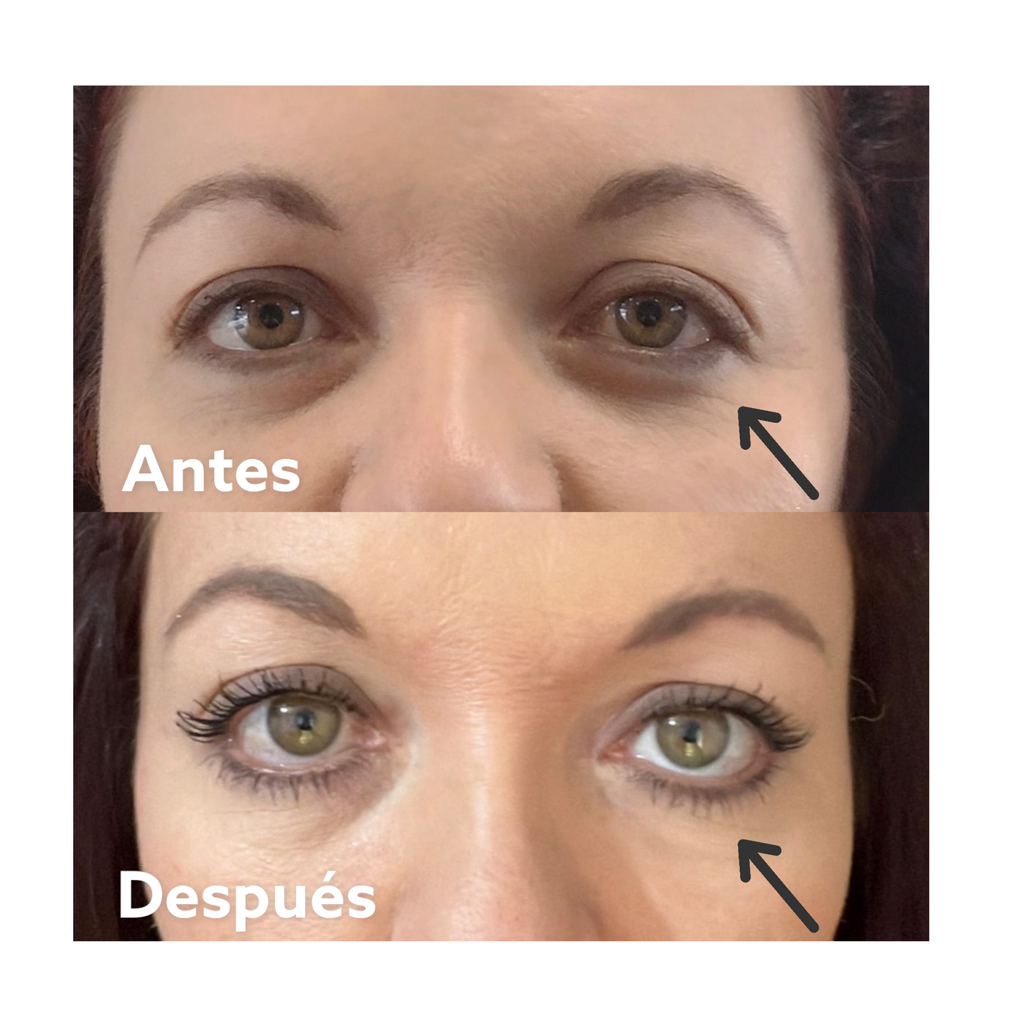 Antiarrugas instantáneo - Age Target