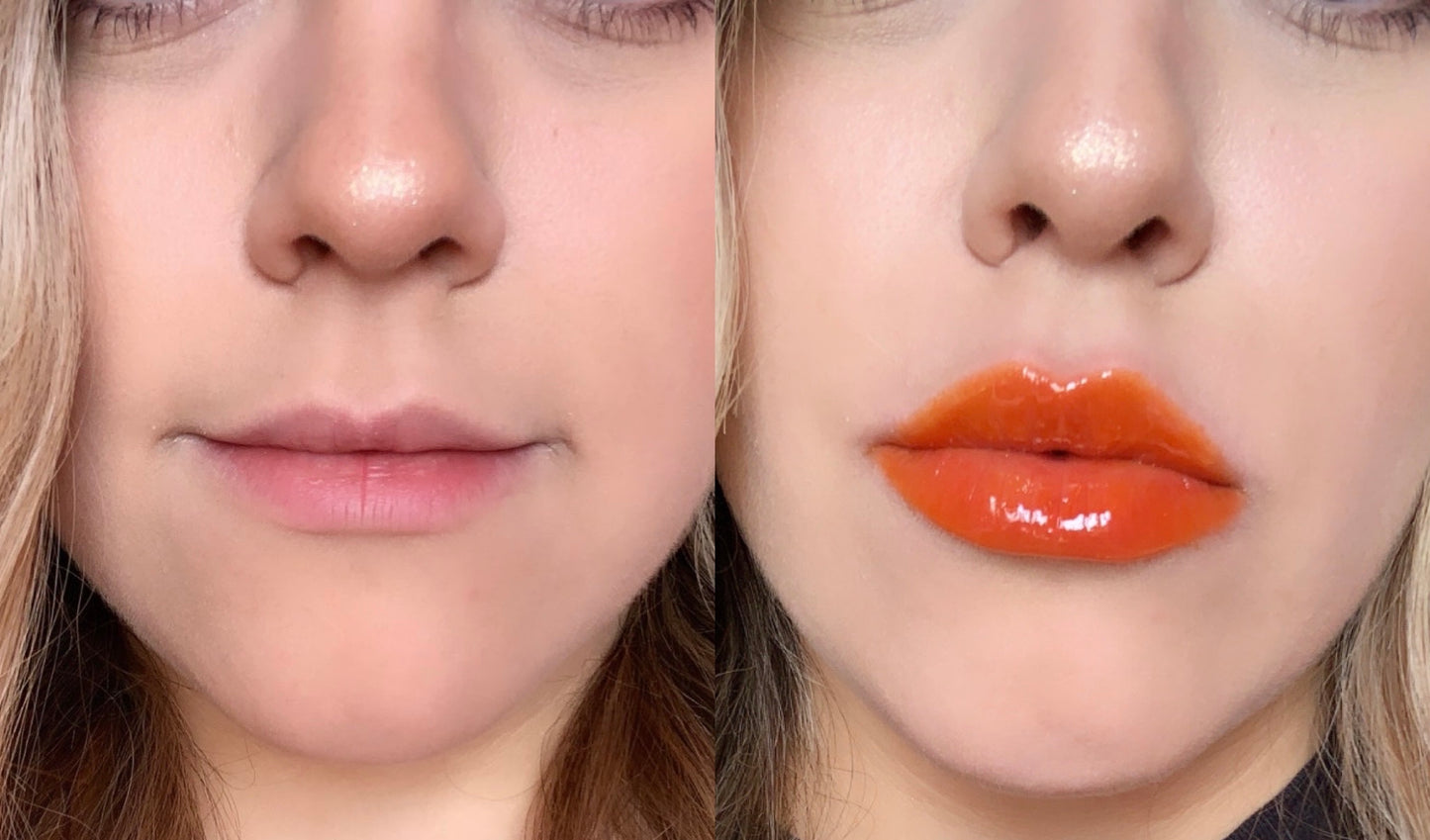 Voluminizador de Labios Grado 3 - Super Ultra Lip Plumper