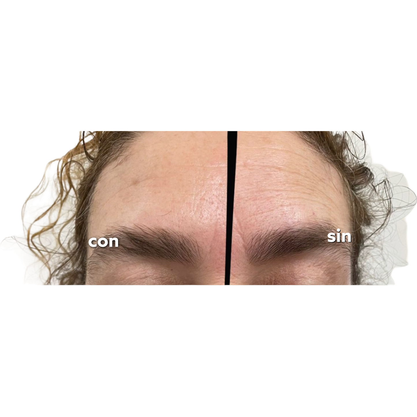 Antiarrugas Instantáneo - Face Plumper